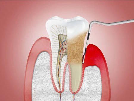 apple-laptop-notebook cirugia periodontal lima