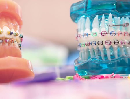 courses-05-free-img ortodoncia lima