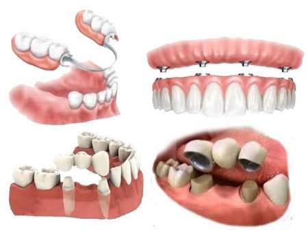 courses-02-free-img rehabilitacion oral lima